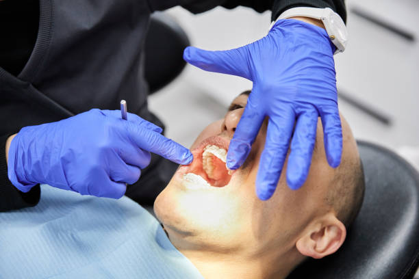 Best Emergency Gum Treatment in Southwood Acres, CT