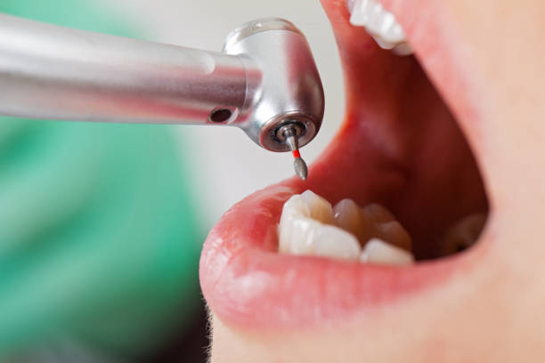 Best Emergency Treatment for Dental Infections or Abscesses in Southwood Acres, CT